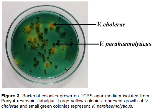 vibrio cholerae tcbs